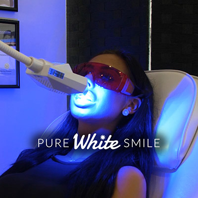 A standard laser teeth whitening treatment at Pure White Smile