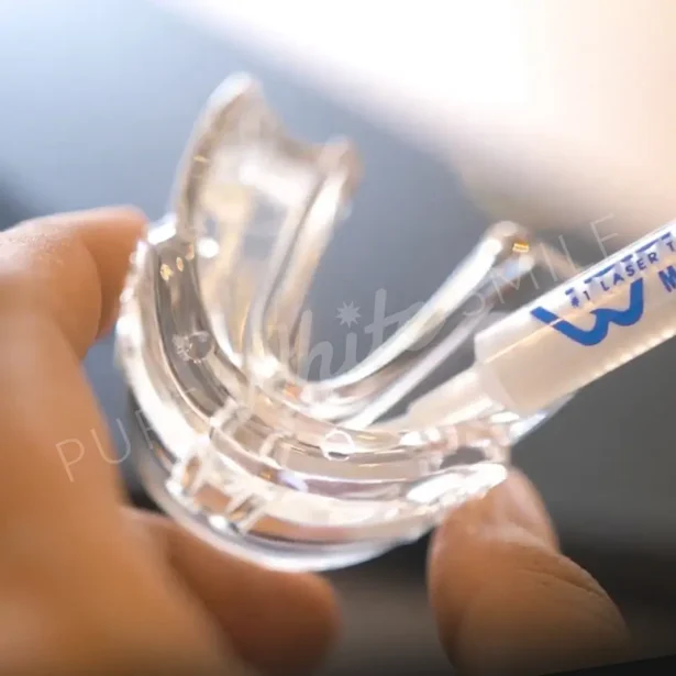 Laser teeth whitening equipment and Blu Forsa gel used together as part of the professional whitening process at Pure White Smile in Chorley, Lancashire.