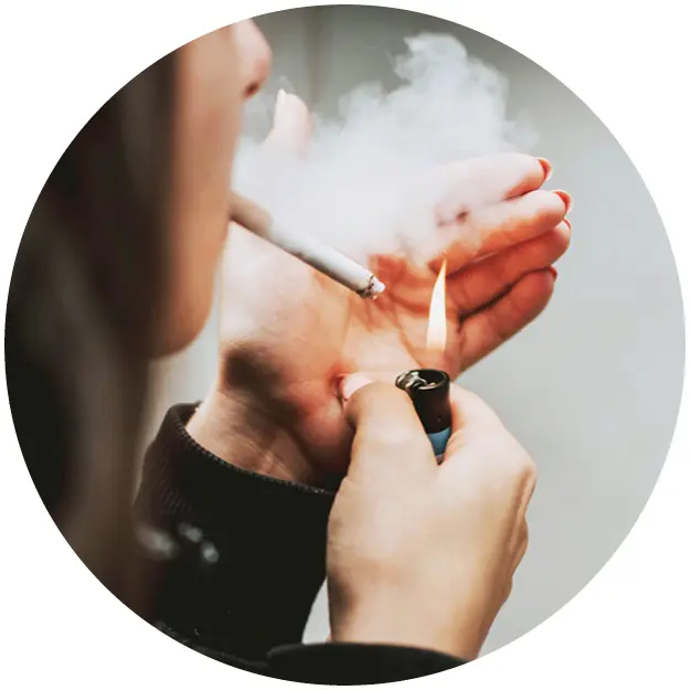 Treatment targeting smoking and lifestyle related tooth staining using laser teeth whitening at Pure White Smile in Chorley.